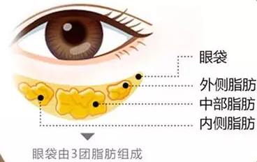 去眼袋手术