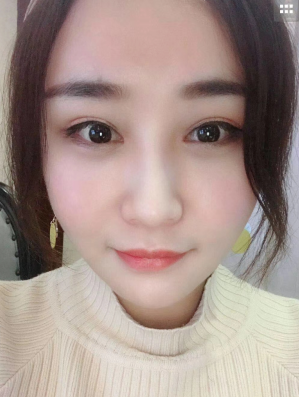 去眼袋手术