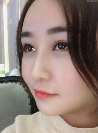 去眼袋手术