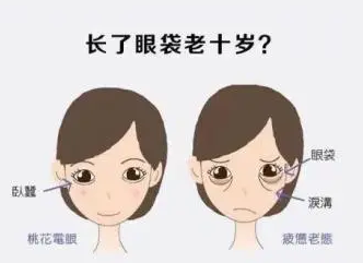 去眼袋手术