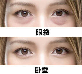 去眼袋手术