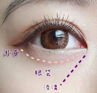 去眼袋手术