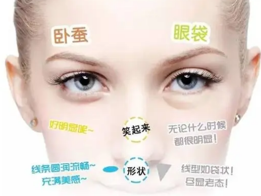 去眼袋手术