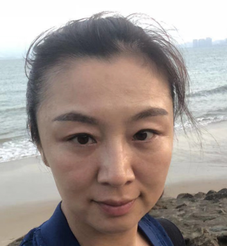 去眼袋手术