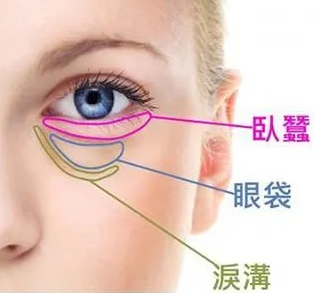 去眼袋手术