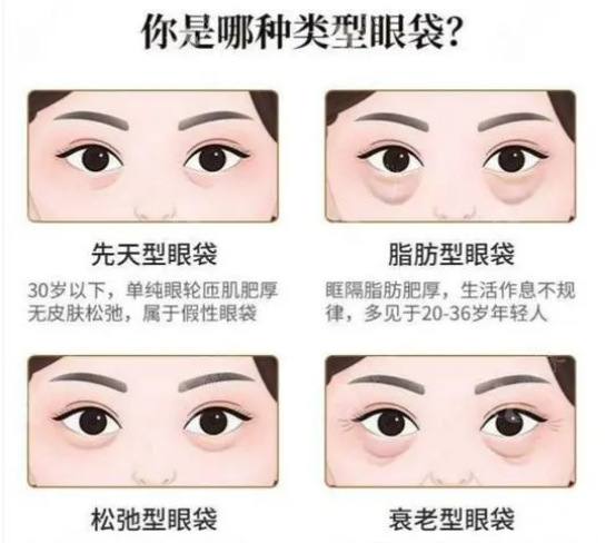 去眼袋手术