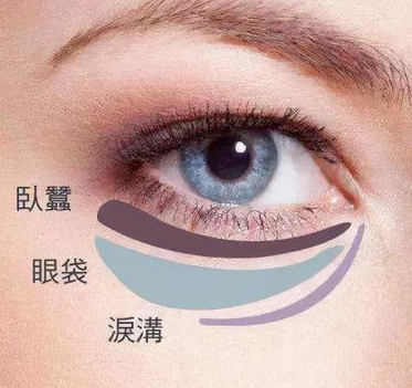 去眼袋手术