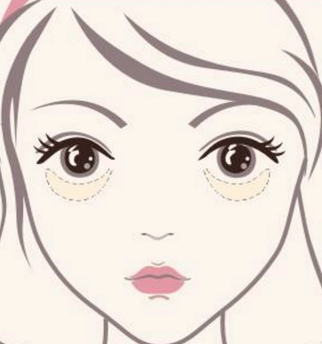 在超雅做了眼袋后你是怎么样保养的?900 在超雅做了眼袋后你是怎么样保养的?900