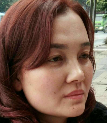 在超雅做了眼袋后你是怎么样保养的?900 在超雅做了眼袋后你是怎么样保养的?900