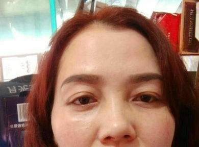 在超雅做了眼袋后你是怎么样保养的?900 在超雅做了眼袋后你是怎么样保养的?900