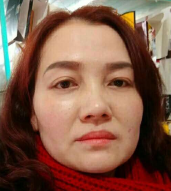 在超雅做了眼袋后你是怎么样保养的?900 在超雅做了眼袋后你是怎么样保养的?900
