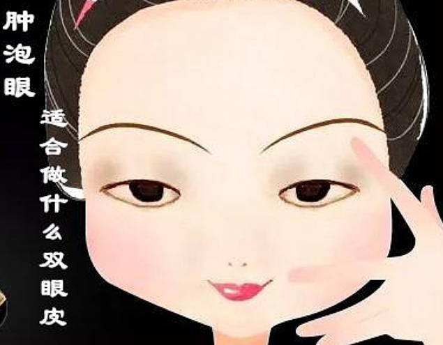 双眼皮手术