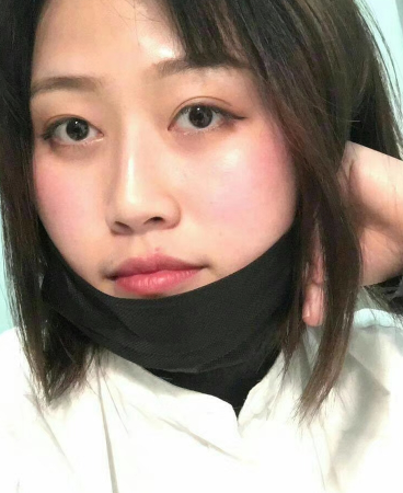 不开刀按摩去眼袋的效果,你如何评价?706 不开刀按摩去眼袋的效果,你如何评价?706