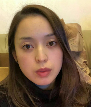 去眼袋手术