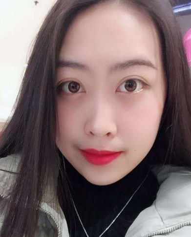 去眼袋手术