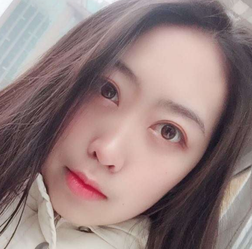 去眼袋手术