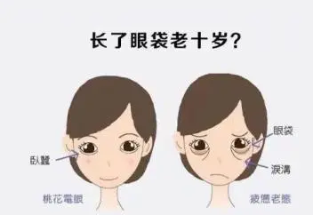 去眼袋手术