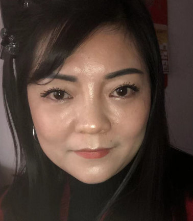 去眼袋手术