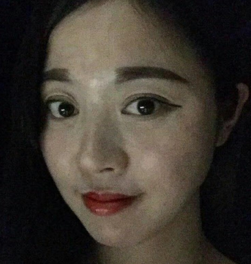 去眼袋手术