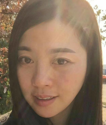 去眼袋手术
