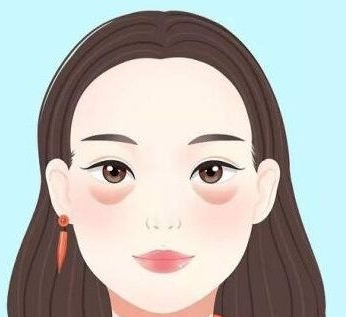 去眼袋手术