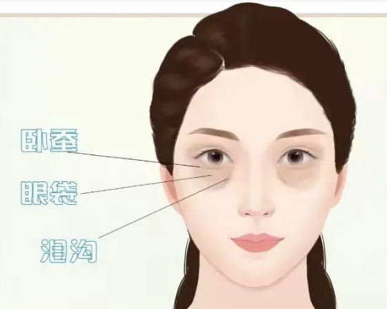 去眼袋手术