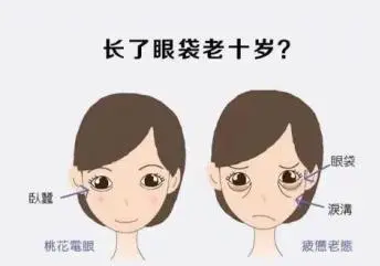 去眼袋手术