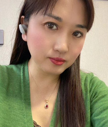 去眼袋手术