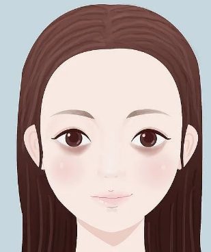 去眼袋手术