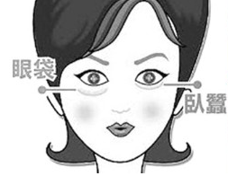 去眼袋手术
