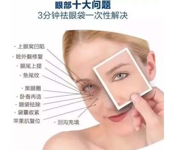 去眼袋手术