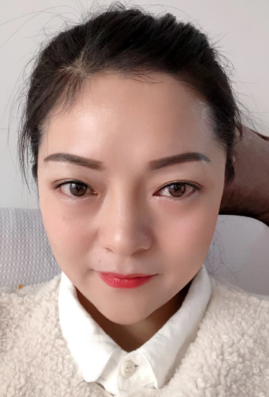 去眼袋手术