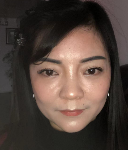 去眼袋手术
