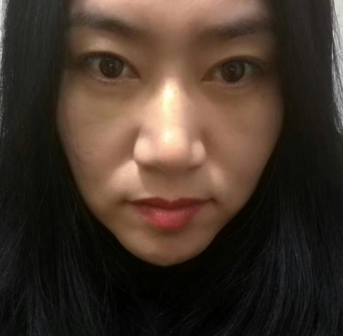 去眼袋手术