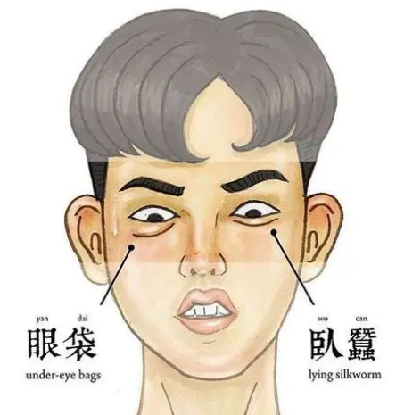 去眼袋手术