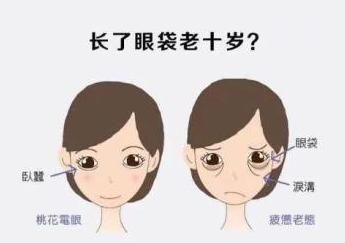 去眼袋手术