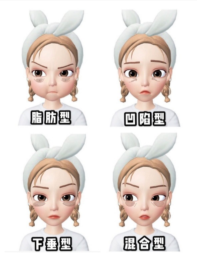 不开刀按摩去眼袋是真实不留任何疤痕的吗?665 不开刀按摩去眼袋是真实不留任何疤痕的吗?665
