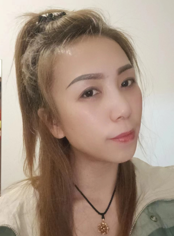 去眼袋手术