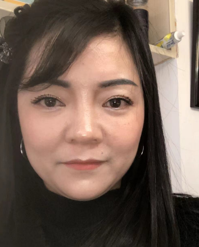 去眼袋手术