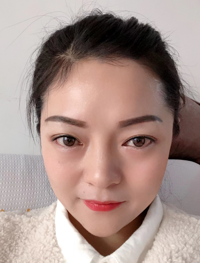 去眼袋手术