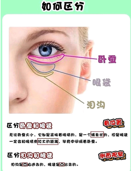 去眼袋手术