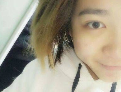 去眼袋手术