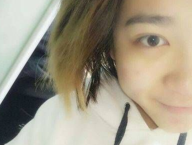 去眼袋手术