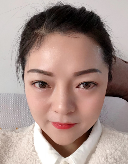 去眼袋手术