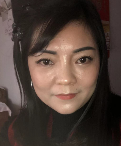 去眼袋手术