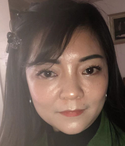 去眼袋手术