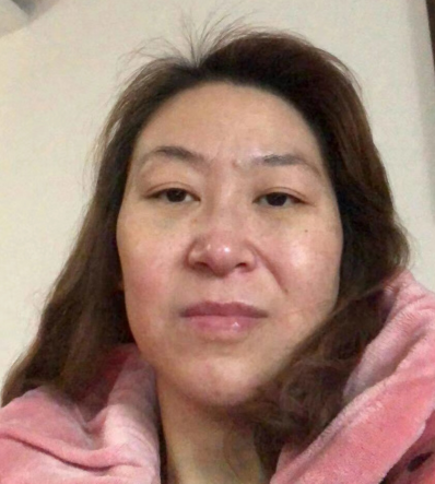 去眼袋手术