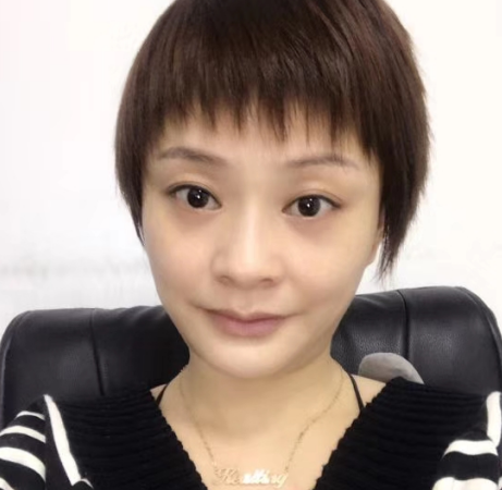 去眼袋手术