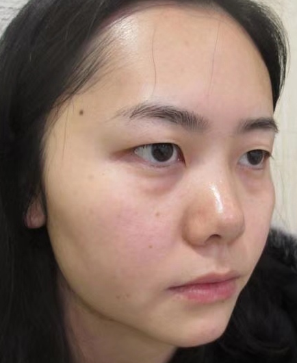 年轻人是会长眼袋的?那你选择怎么解决?567 年轻人是会长眼袋的?那你选择怎么解决?567