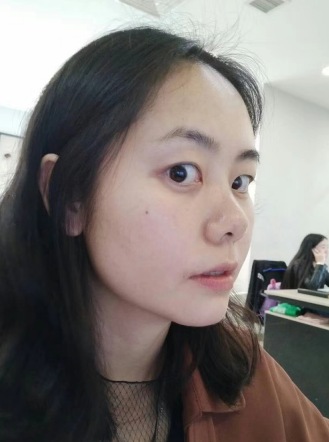 年轻人是会长眼袋的?那你选择怎么解决?567 年轻人是会长眼袋的?那你选择怎么解决?567